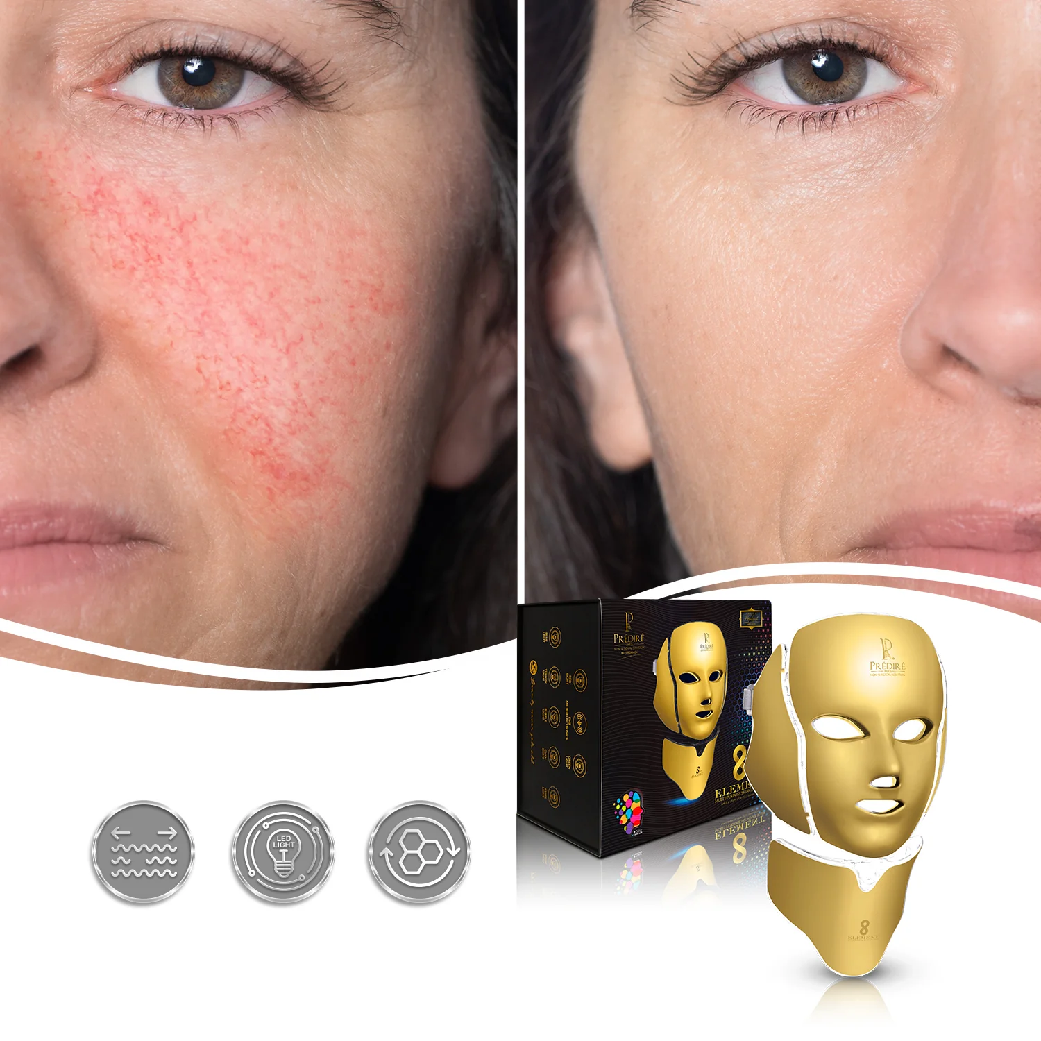 8 Element Multi-Purpose Skincare Mask (GOLD) | Non-Surgical Solution LED Treatment - Image 4