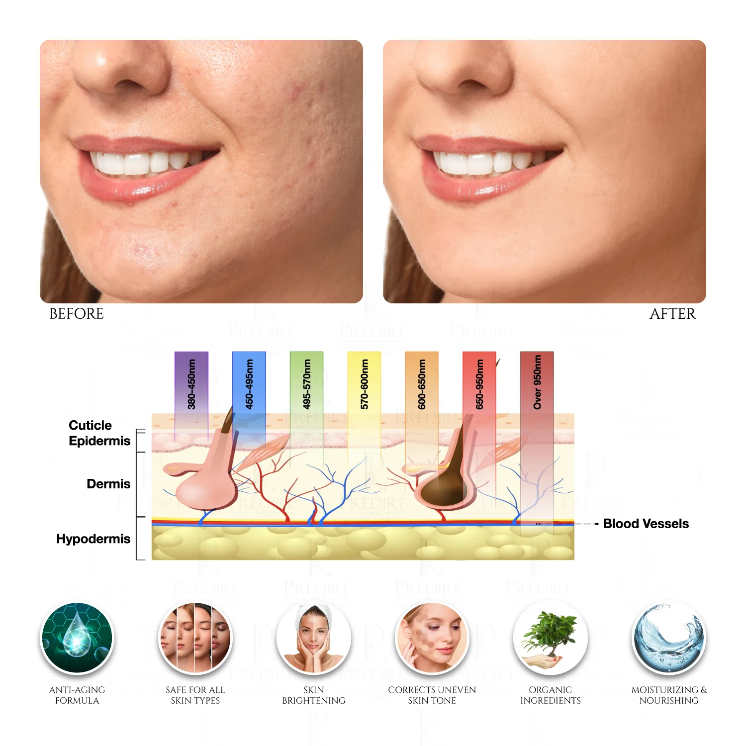 8 Element Multi-Purpose Skincare Mask | Non-Surgical Solution LED Treatment - Image 4