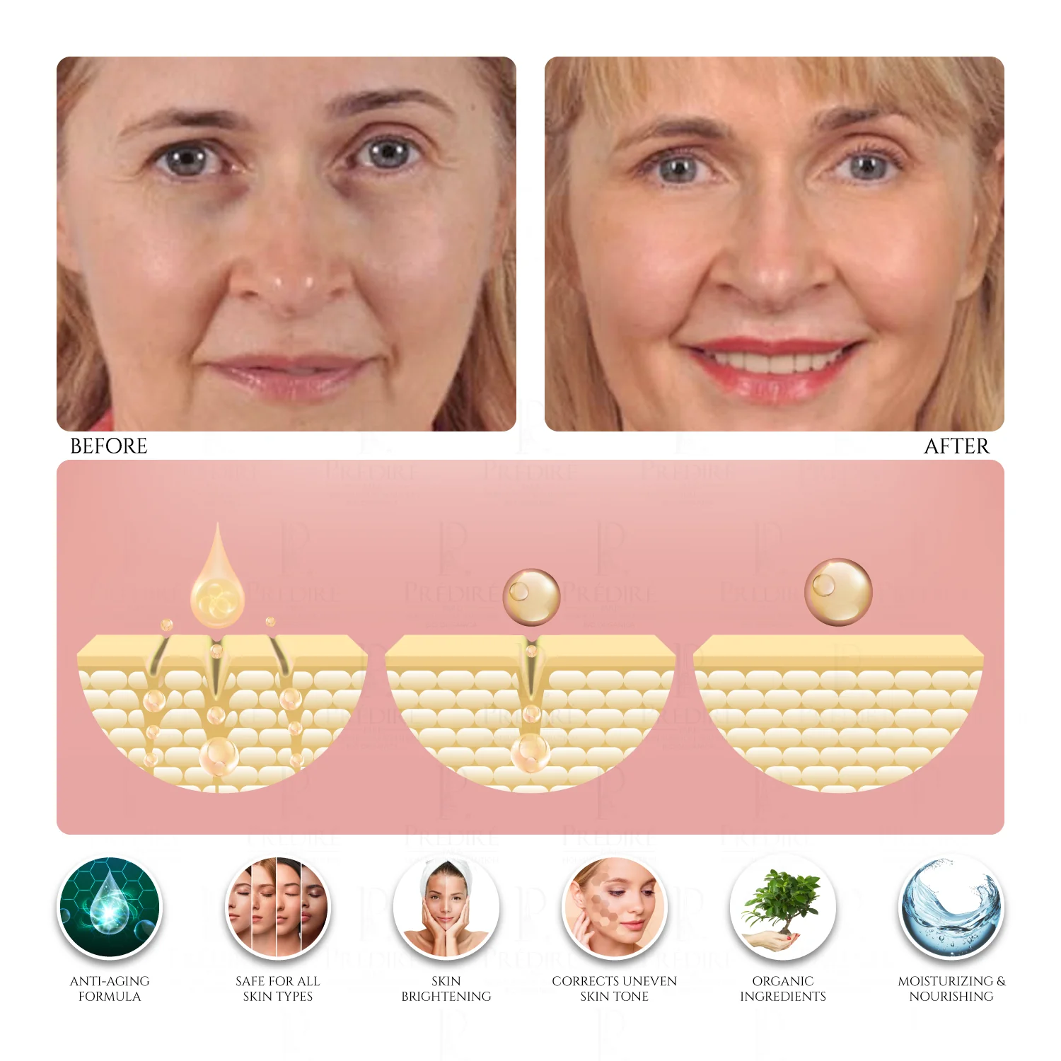 Caviar Hyaluronic Acid Age-Defying Collection | Renew, Moisturize, Cream, Serum, Mask & Toner | Limited Edition - Image 5