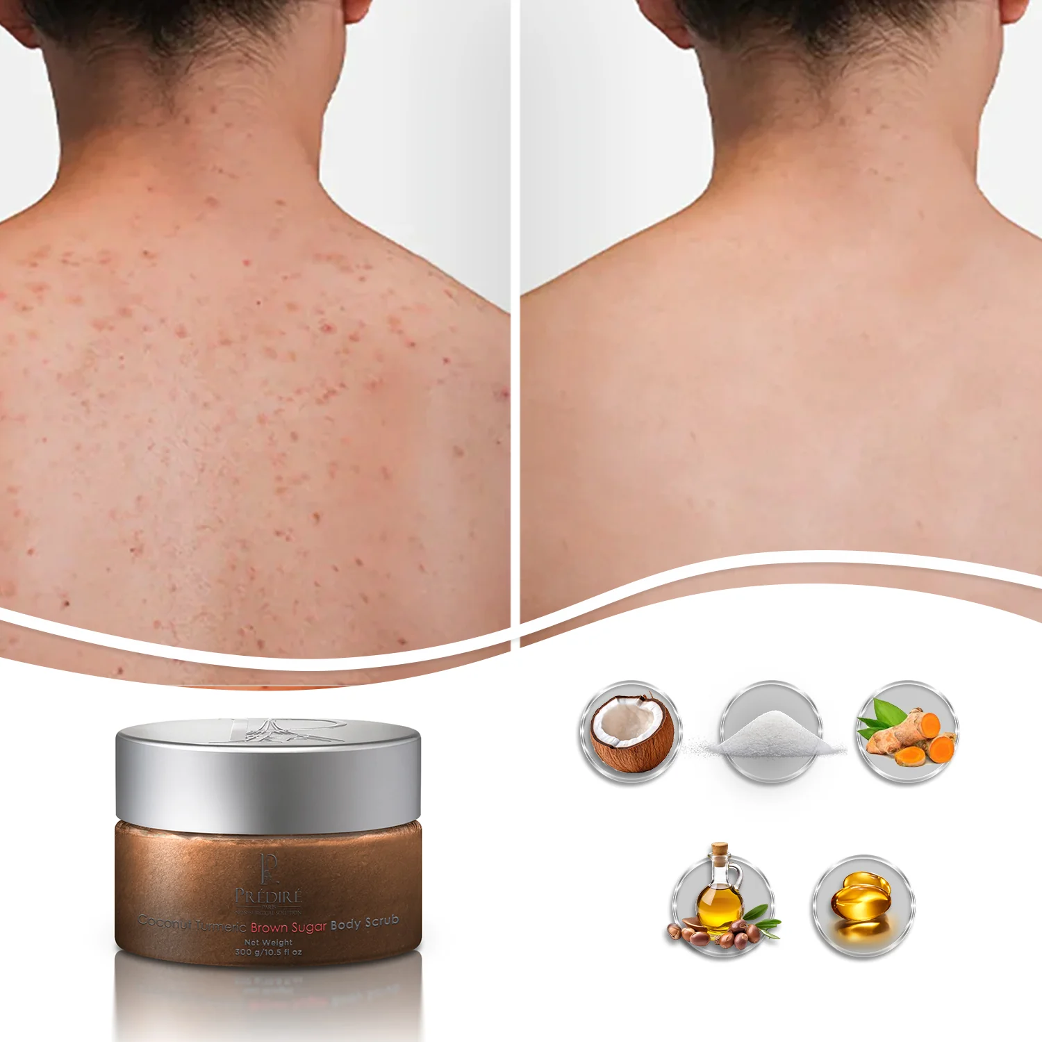 Coconut Turmeric Brown Sugar Body Scrub - Image 2
