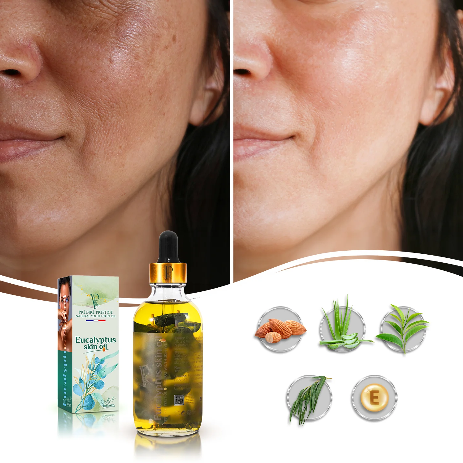 Eucalyptus Skin Oil - Image 4