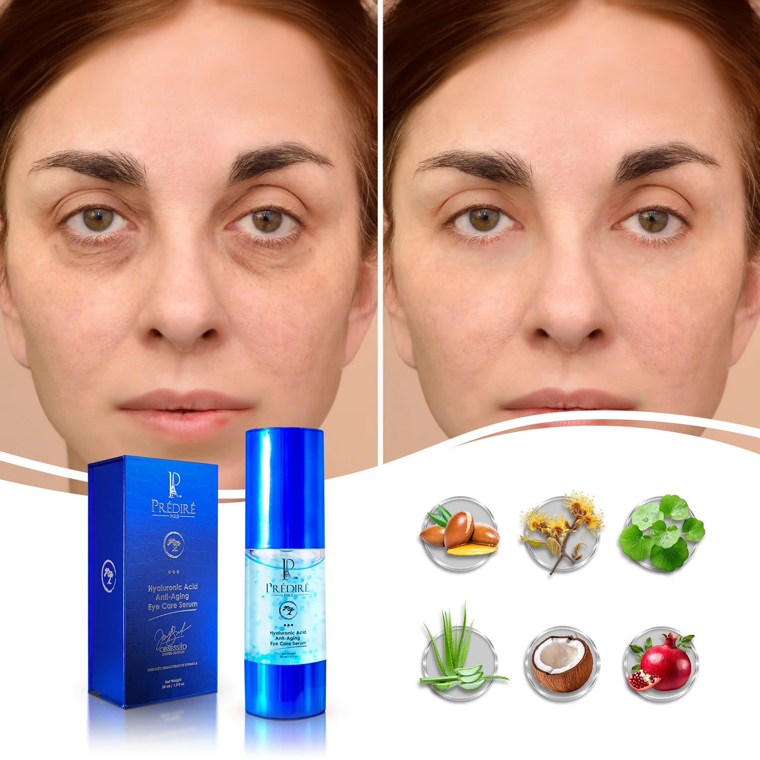Intensive Rapid Renewal Eye Care Hyaluronic Acid Anti-Aging  Eye Care Serum - Image 3