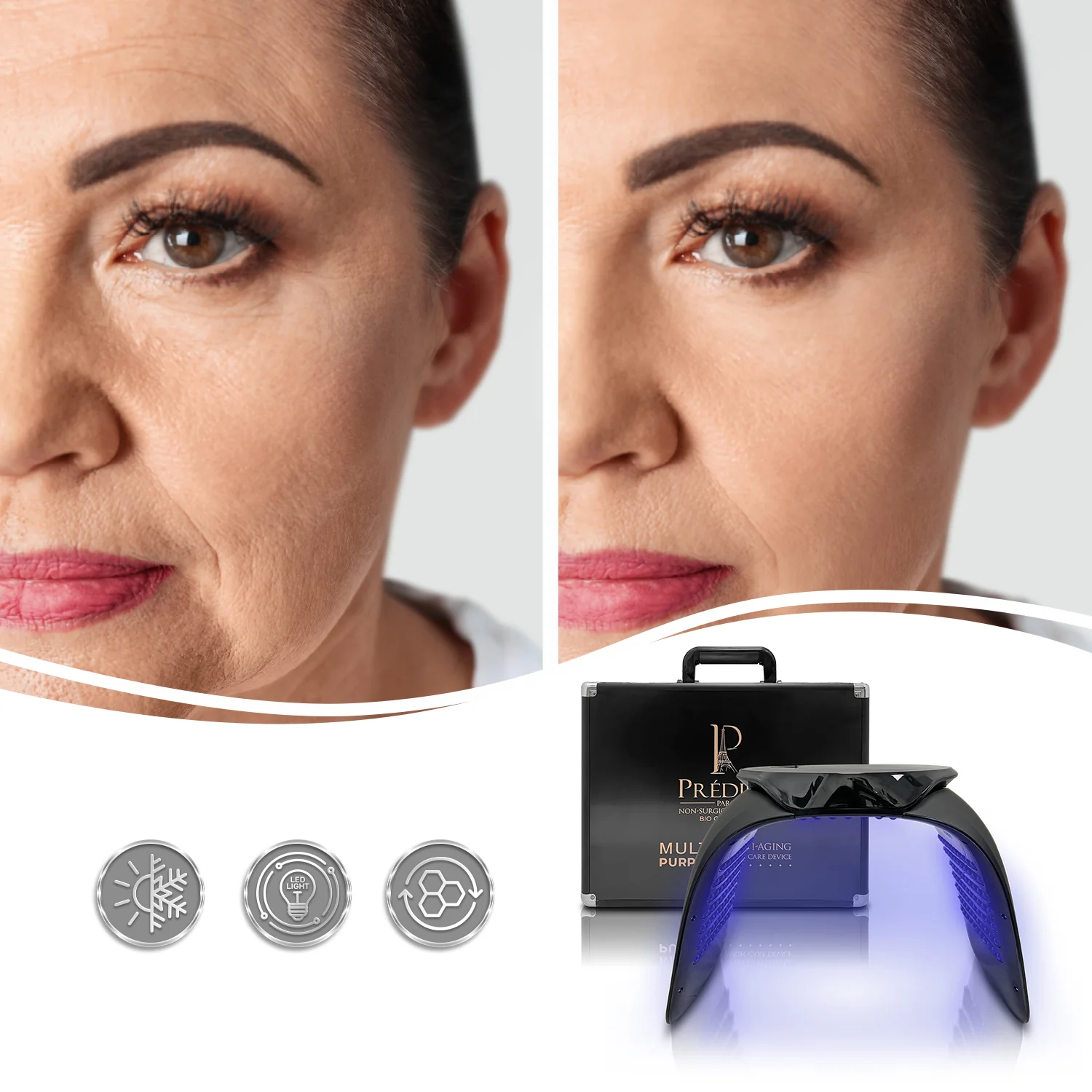 Multi-Purpose Anti-Aging Skin Care Device - Image 5