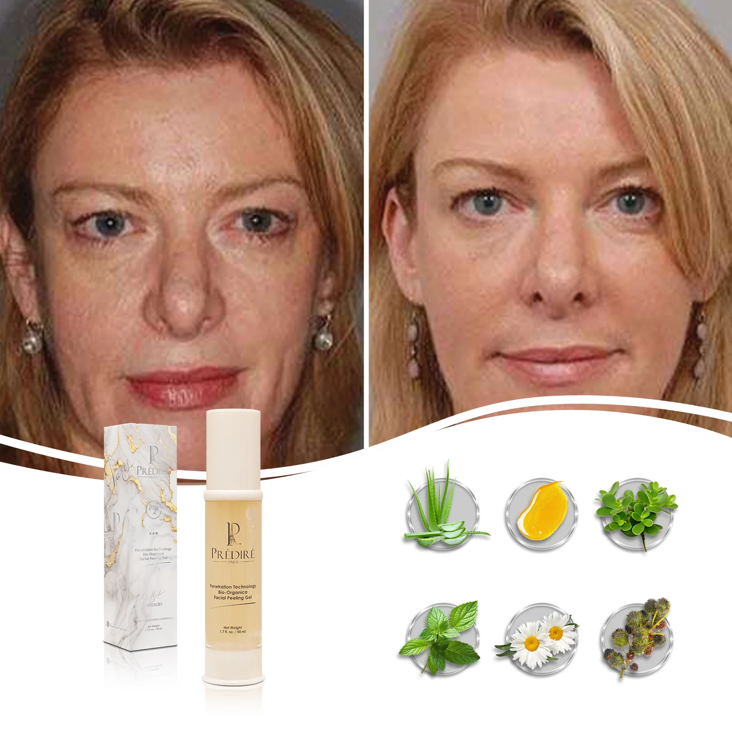 Bio Brightening Penetration Technology Bío-Organic Facial Peeling Gel (Enriched with Vitamin E & A) - Image 4