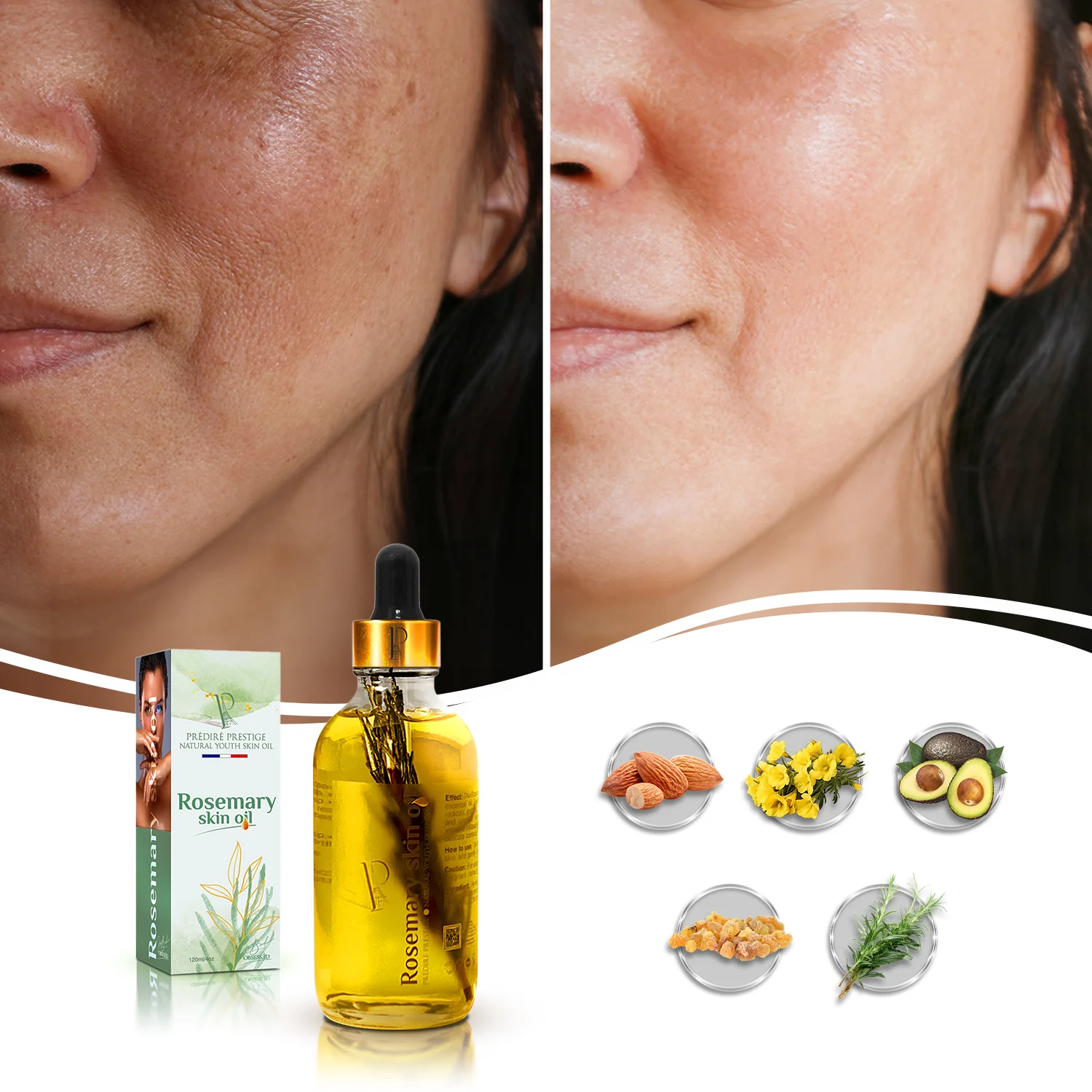 Rosemary Skin Oil - Image 4