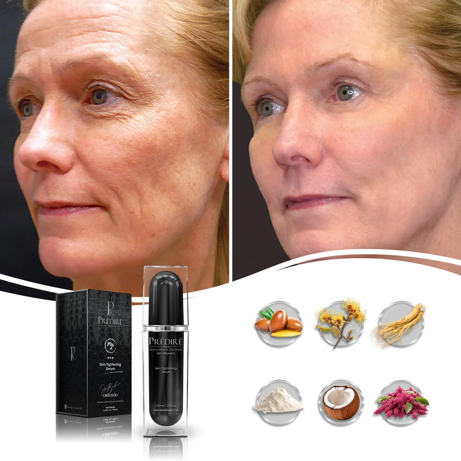 Skin Tightening & Tissue Bonding Serum (Enriched with Vitamin E & Retinol) - Image 5