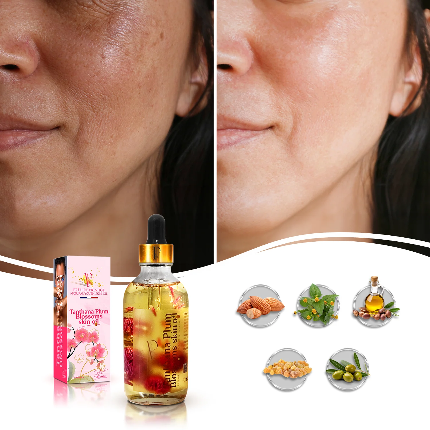 Tanthana Plum Blossoms Skin Oil - Image 4