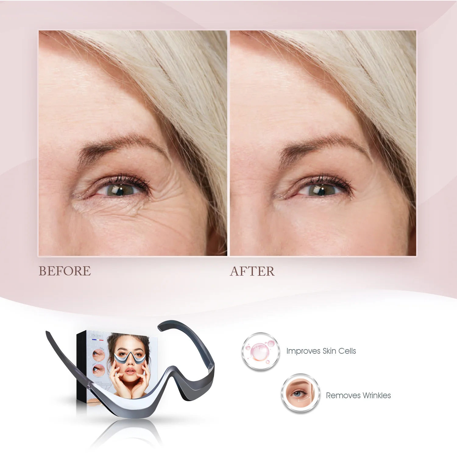 Undereye EMS Leader Device | Relax Eyes, Micro-Massage, Remove Wrinkles, EMS - Image 6