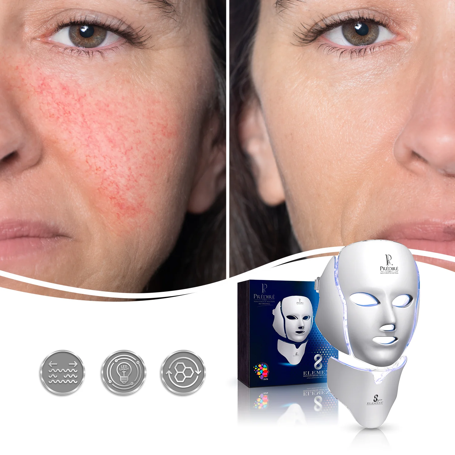 8 Element Multi-Purpose Skincare Mask | Non-Surgical Solution LED Treatment - Image 9