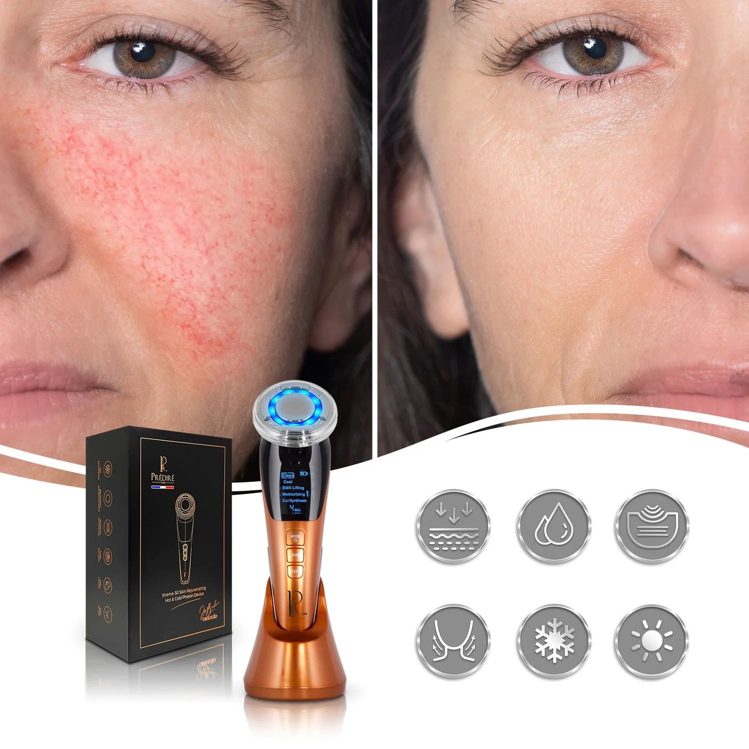 Xtreme-50 Skin Rejuvenating Hot & Cold Photon Device - Image 4