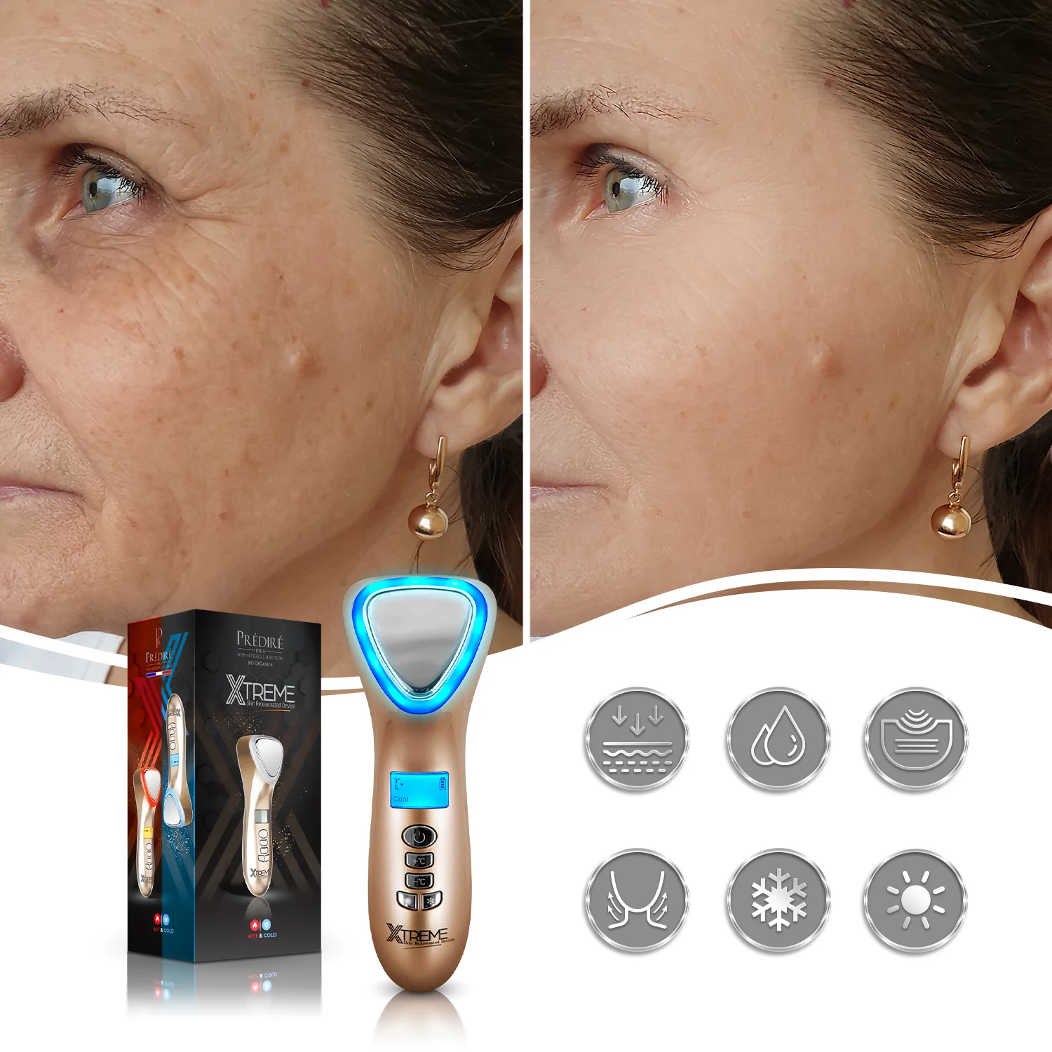 XTREME Skin Rejuvenation Device | Hot & Cold LED Light Therapy Anti-Aging Massager with Sonic Vibration - Image 3